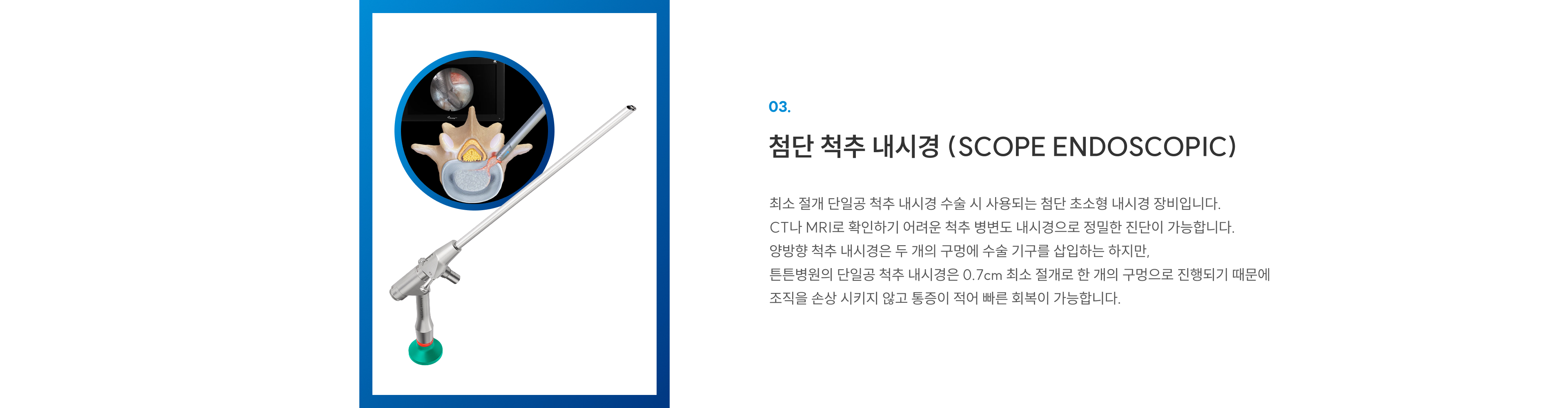첨단장비 03 첨단 척추 내시경: 단일공 0.7cm 최소절개로 CT·MRI로 못 보는 병변까지 정밀 진단, 손상·통증 적고 빠른 회복