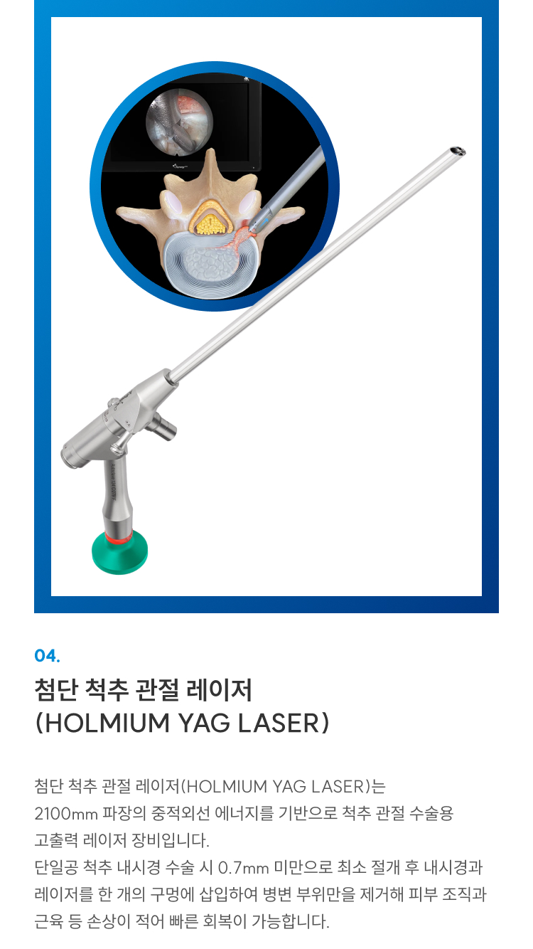 첨단장비 04 첨단 척추 관절 레이저(Holmium YAG): 최소 절개로 병변만 제거, 조직 손상 적고 빠른 회복