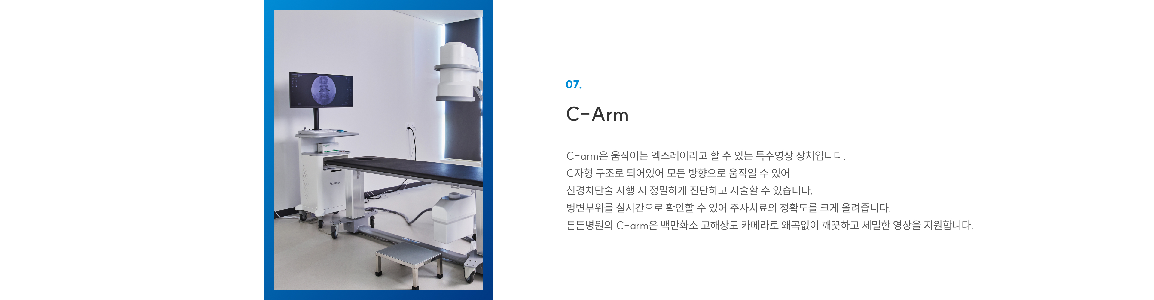 첨단장비 07 C-Arm: 움직이는 특수 엑스레이로 신경차단술·주사치료 정밀 시술, 백만화소 고해상도 영상