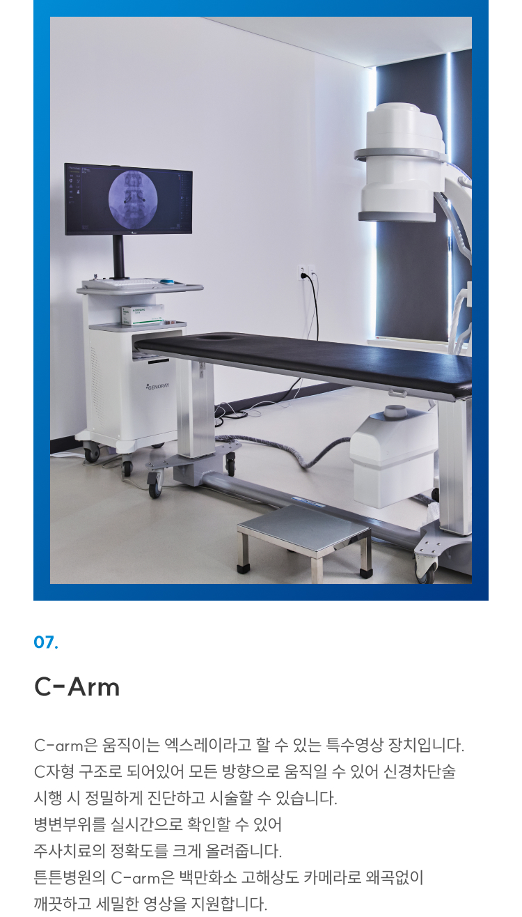 첨단장비 07 C-Arm: 움직이는 특수 엑스레이로 신경차단술·주사치료 정밀 시술, 백만화소 고해상도 영상
