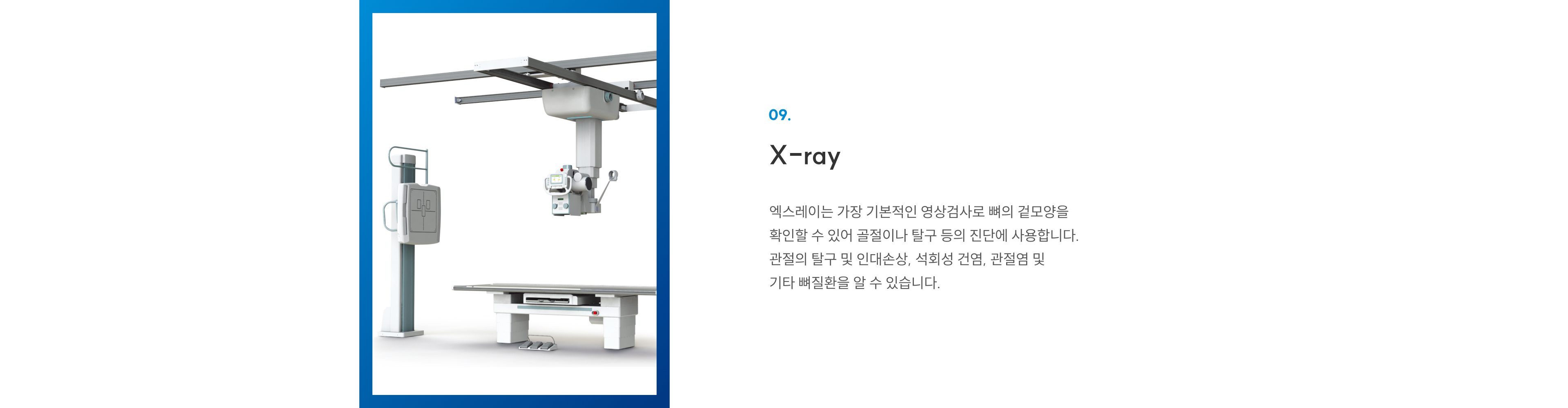 첨단장비 09 X-ray: 골절·탈구·인대손상·석회성건염·관절염 등 뼈질환 기본 영상검사