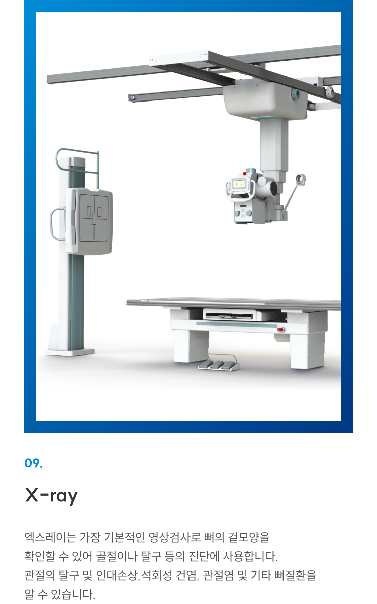 첨단장비 09 X-ray: 골절·탈구·인대손상·석회성건염·관절염 등 뼈질환 기본 영상검사