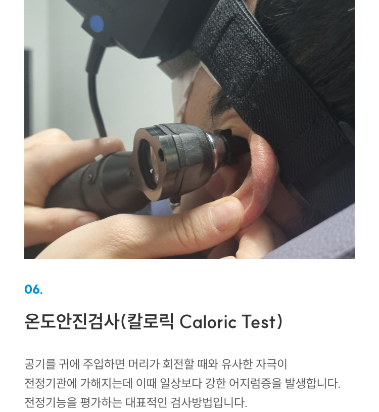 첨단장비(이비인후과) 06 온도안진검사(Caloric Test): 귀에 공기 주입해 전정기능 평가하는 대표 검사