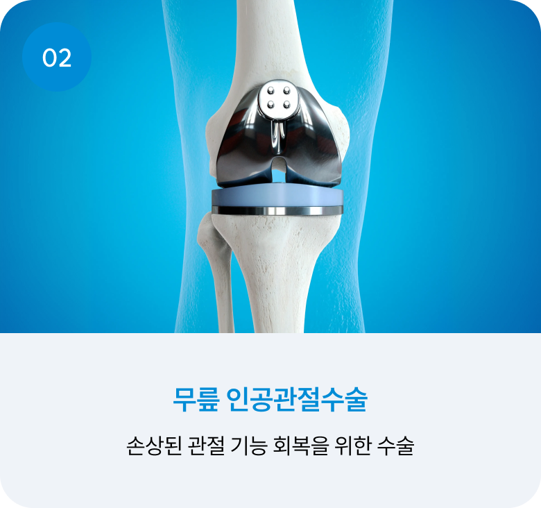 02 무릎 인공관절수술 : 손상된 관절 기능 회복을 위한 수술