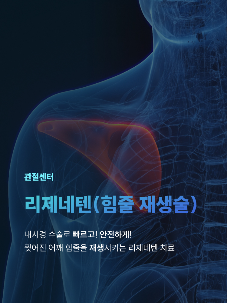 관절센터 리제네텐(힘줄 재생술) - 내시경 수술도 빠르고 안전하게! 찢어진 어깨 힘줄을 재생시키는 리제네텐 치료