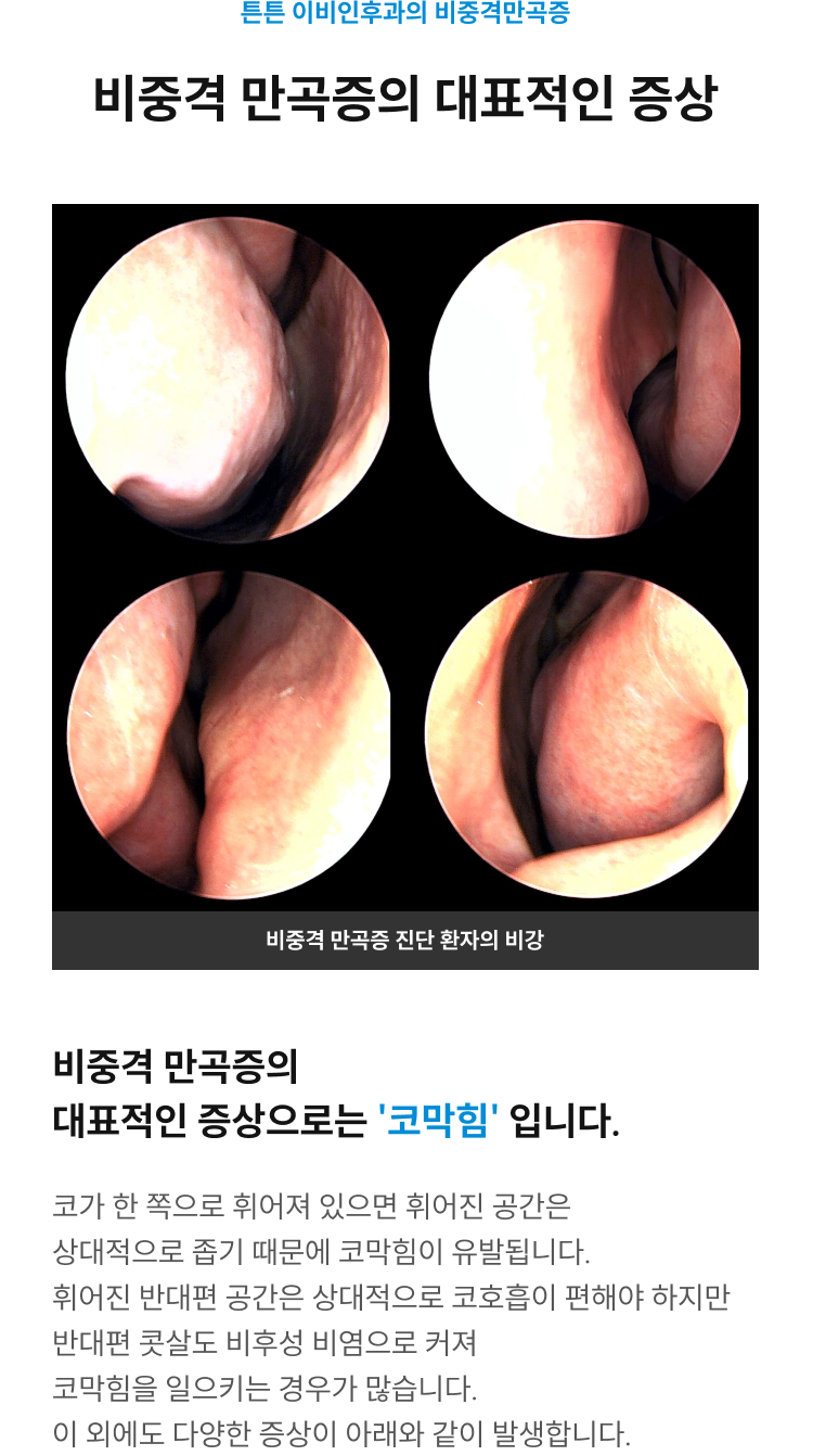 비중격 만곡증의 대표적인 증상은 코막힘 - 비중격 만곡증 진단 환자의 비강 내시경 사진