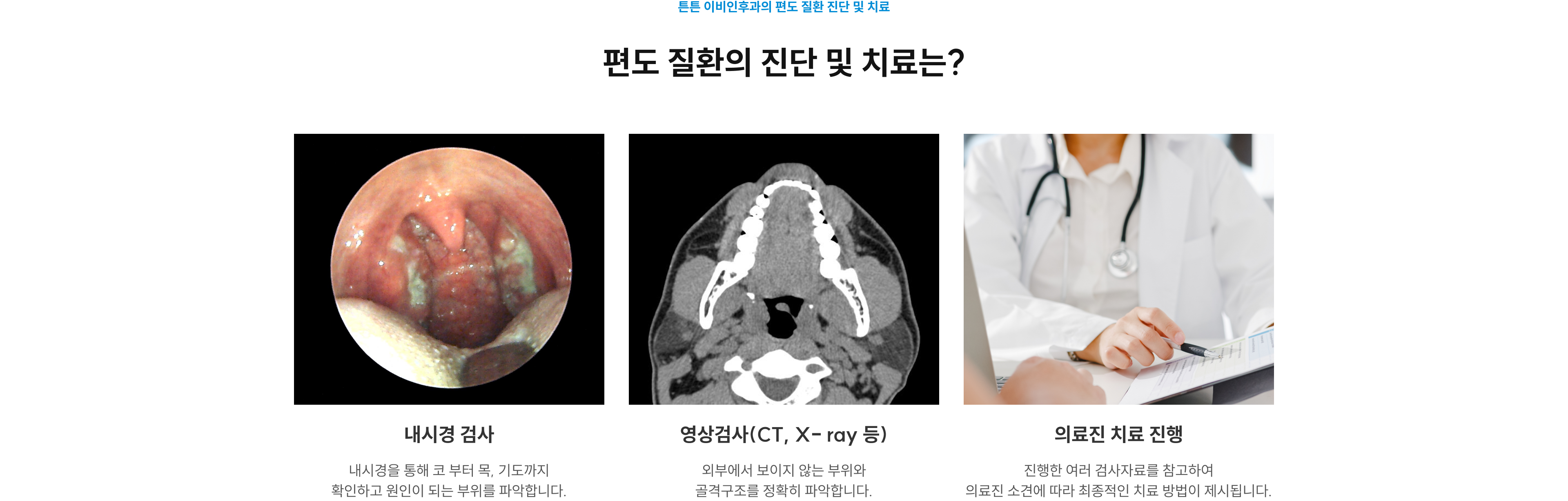 편도 질환의 진단 및 치료 - 내시경 검사, 영상검사(CT, X-ray 등), 의료진 소견에 따른 치료 진행