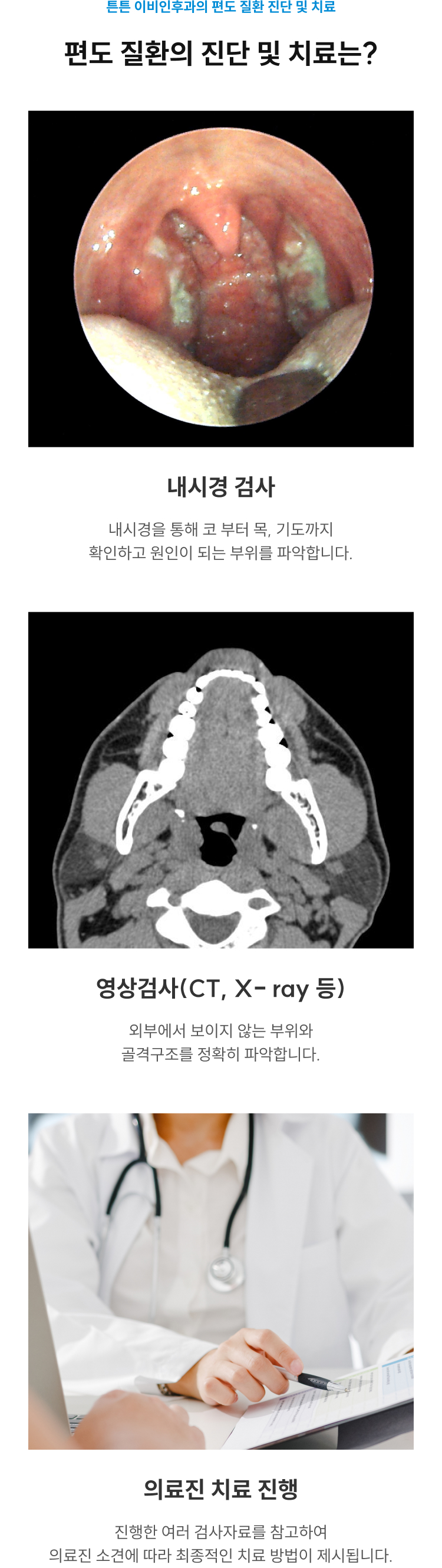 편도 질환의 진단 및 치료 - 내시경 검사, 영상검사(CT, X-ray 등), 의료진 소견에 따른 치료 진행