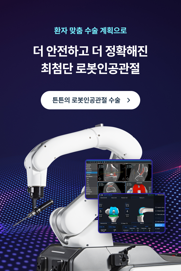 환자 맞춤 수술 계획으로 더 안전하고 더 정확해진 최첨단 로봇인공관절 수술
