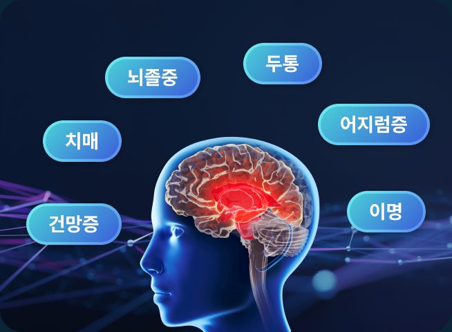 대표적인 뇌신경질환 - 뇌졸중, 치매, 건망증, 두통, 어지럼증, 이명