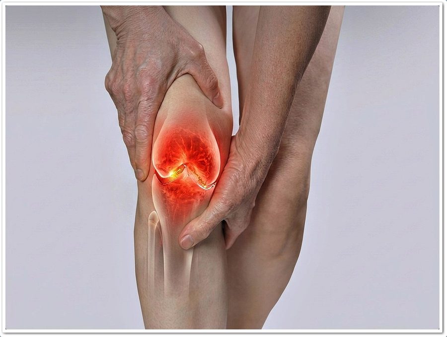 검사는 정상인데 계단마다 무릎 뚝 소리, 원인과 재진료 기준 관련 사진