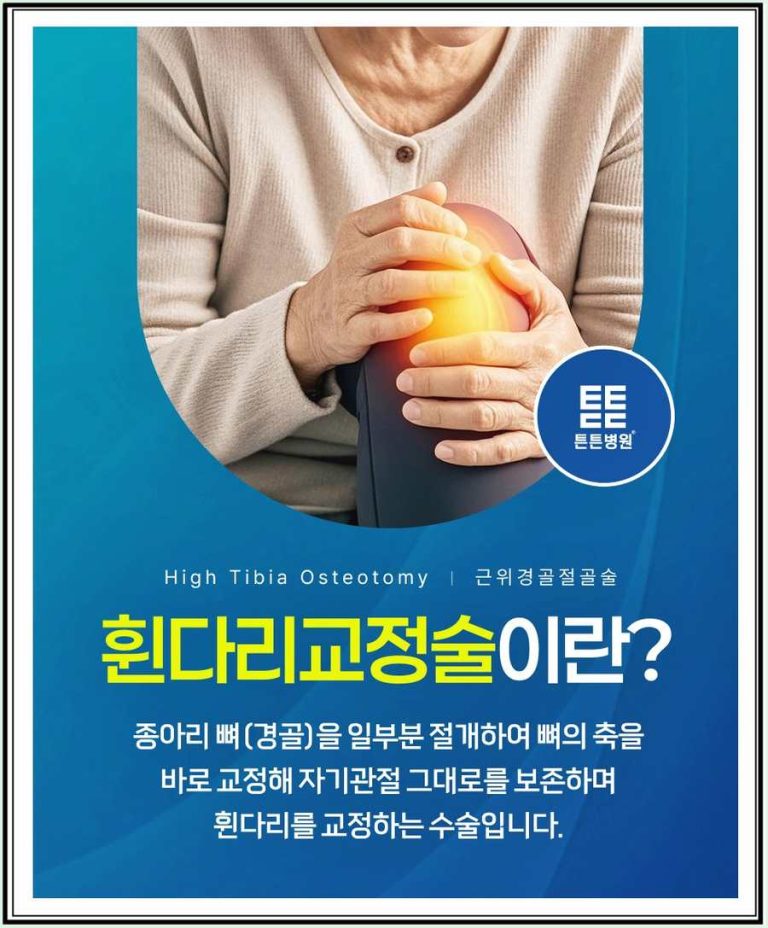 O자 다리 무릎 안쪽 통증, 인공관절 전 휜다리교정술 가능 기준 관련 사진