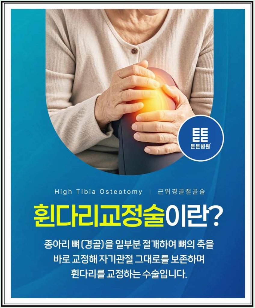 O자 다리 무릎 안쪽 통증, 인공관절 전 휜다리교정술 가능 기준 관련 사진